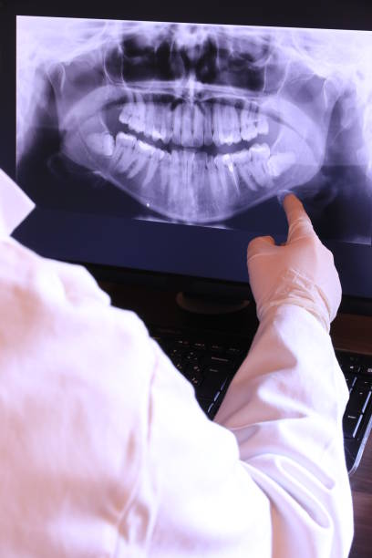 Best Emergency Dental Care for Abscessed Tooth in Jacksboro, TX